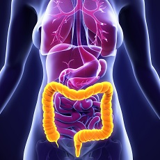 Colonic Polyps